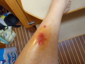 Det gäller att ta det lugnt på stegen